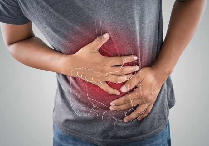 THE TREATMENT OPTIONS FOR ULCERATIVE COLITIS