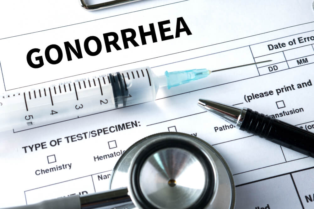 gonorrhea symptoms women