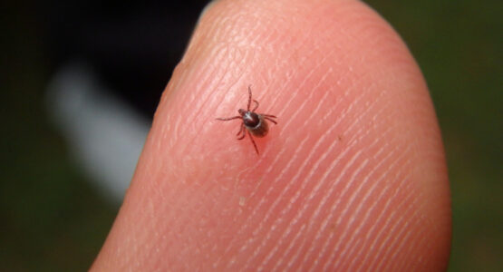 A tick on a person's finger.