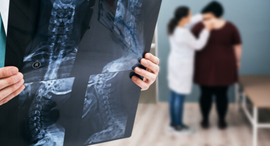 A doctor holds an x-ray showing scoliosis