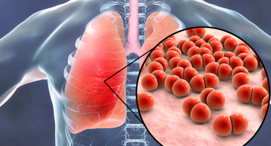 Various Disease affect parts of the lungs