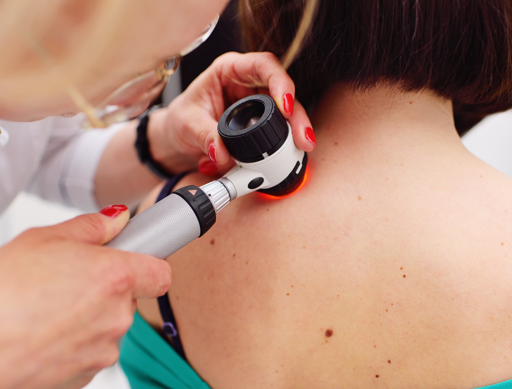 Signs and symptoms of skin cancer