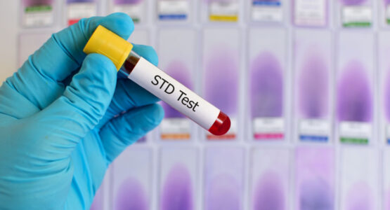 STD testing tube