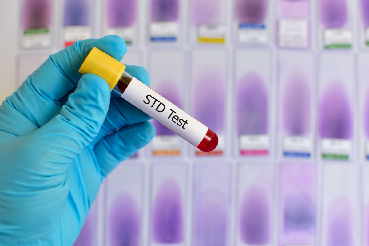 STD testing tube