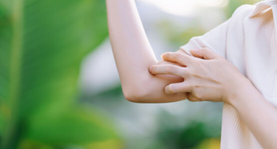 Person Itching Arm