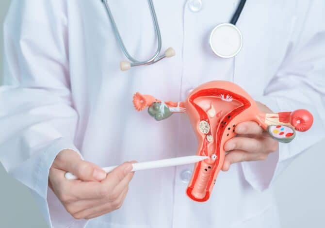 Doctor holding Uterus and Ovaries model. Ovarian and Cervical cancer, Cervix disorder, Endometriosis, Hysterectomy, Uterine fibroids, Reproductive system and Pregnancy concept